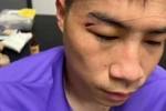 津媒:王献钧两颗门牙被撞断,杨帆眉骨受伤赛后去医院缝针